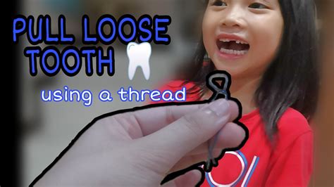 How To Pull A Tooth With Thread