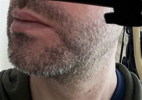 How To Put Sunscreen On Beard