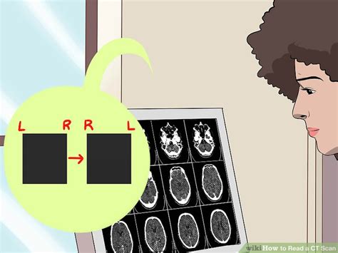 How To Read A Ct Scan Image