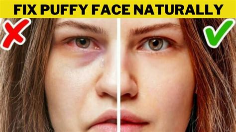 How To Reduce Fluid Retention In Face
