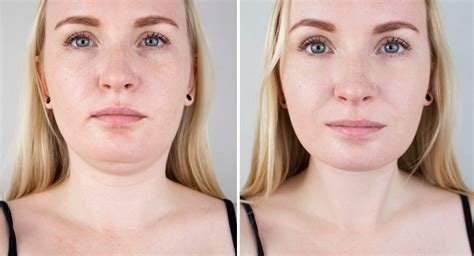 How To Reduce The Look Of Double Chin  Tips And Tricks