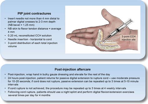 how to reduce pip after injection