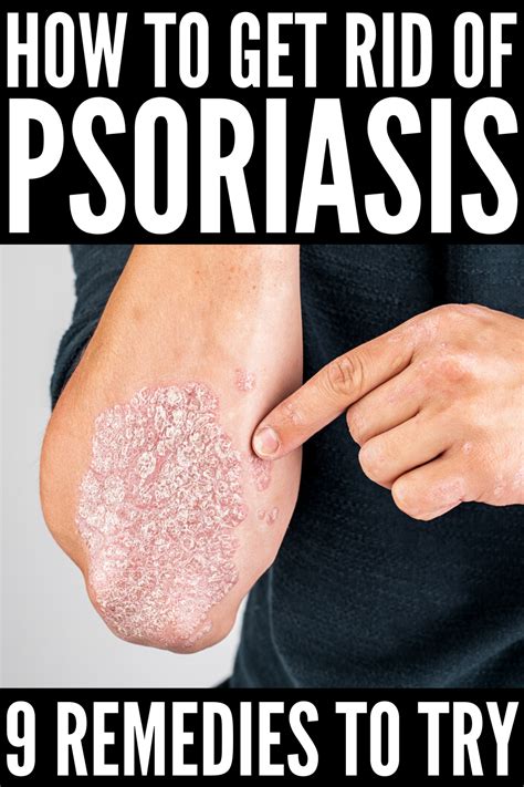 how to reduce psoriasis inflammation