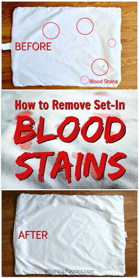 How To Remove A Blood Stain From A Sheet