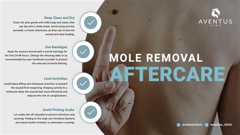 Removing Moles Safely: A Step-by-Step Guide on How to Remove a Mole