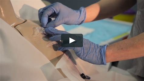 How To Remove A Port Needle