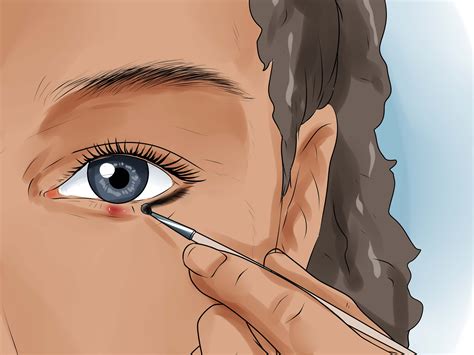 how to remove a stye on eyelid