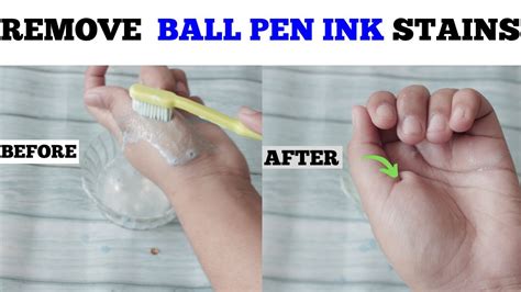 How To Remove Ballpoint Ink From Hands