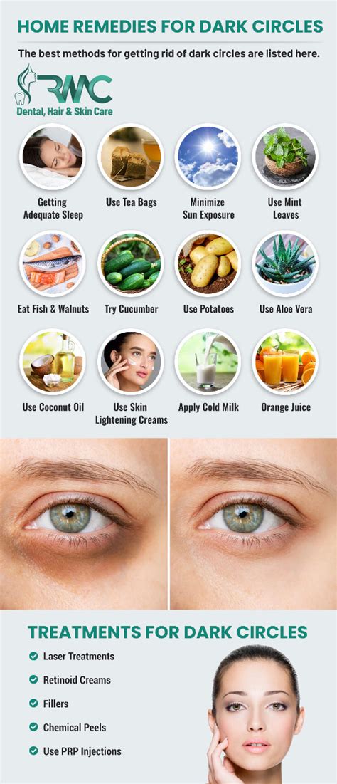 How To Remove Dark Circles In One Hour
