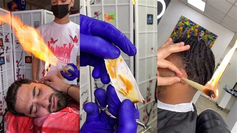 How To Remove Ear Wax Using Fire