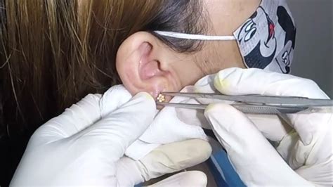 How To Remove Earring In Ear