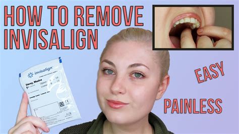 how to remove invisalign trays with attachments