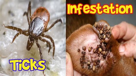 How To Remove Sheep Ticks From Humans
