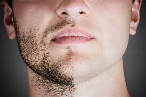 how to remove stubble after shaving