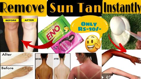 How To Remove Tan In Body