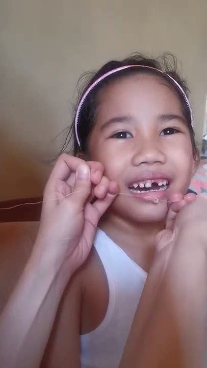 How To Remove Teeth Using Thread