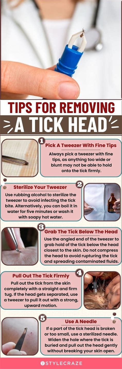 How To Remove Tick When Head Is In