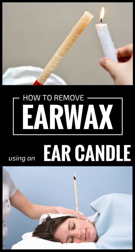 How To Remove Wax From Ear Using Candle