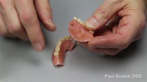 how to repair broken dentures at home