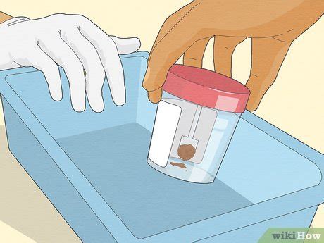 How To Stool Sample Diarrhea