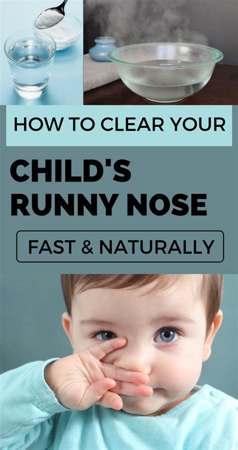 how to stop a runny nose in babies
