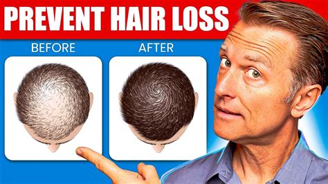 How To Stop Balding And Regrow Hair Home Remedies