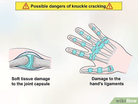 how to stop cracking fingers