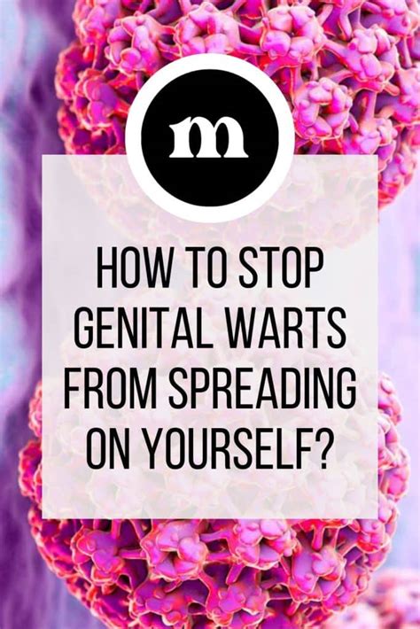 how to stop hpv warts from spreading