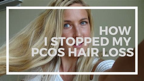 How To Stop Pcos Hair Loss  A Comprehensive Guide