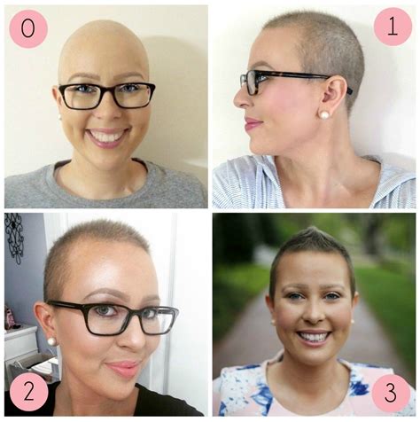 Fresh How To Style Hair After Chemo For Bridesmaids