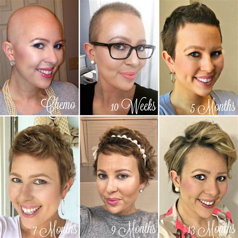 Unique How To Style Hair Growing Out From Chemo For New Style