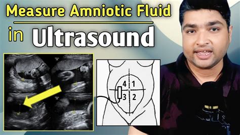 How To Test Amniotic Fluid Levels