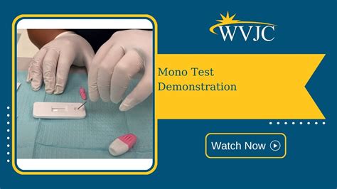 Accurate Diagnosis: How to Test for Mono Effectively Today