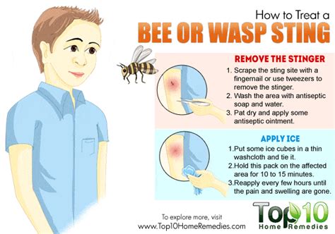 how to treat bee sting on head