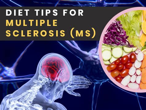 how to treat multiple sclerosis with diet