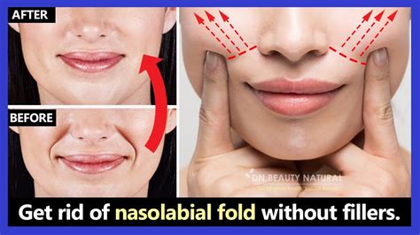How To Treat Nasolabial Folds Without Fillers In 2023