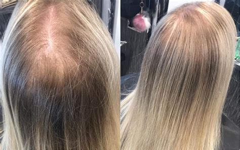 How To Treat Really Thin Hair  A Comprehensive Guide