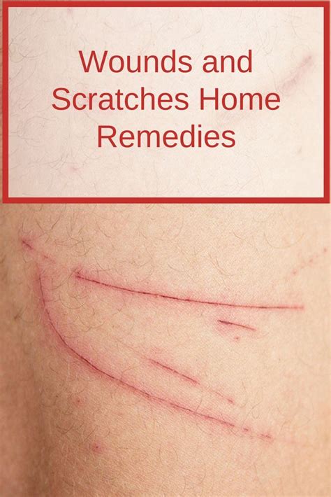 how to treat scratches on skin