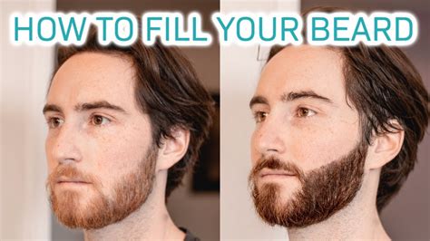 How To Trim Beard That's Patchy