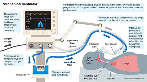 How To Understand Mechanical Ventilation