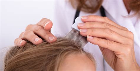 How To Use A Nit Comb