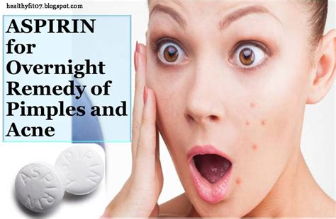 how to use aspirin to remove pimples