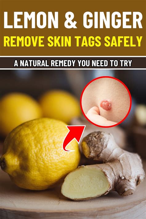 How To Use Ginger To Remove Pimples
