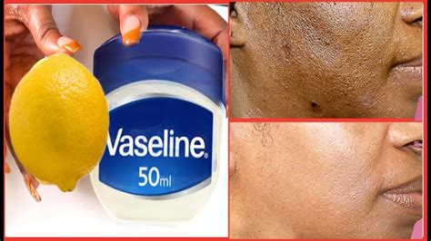 how to use lemon and vaseline on face for wrinkles