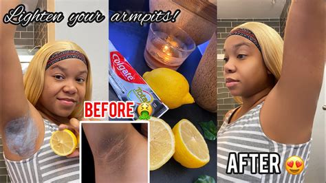 How To Use Lemon To Lighten Armpits