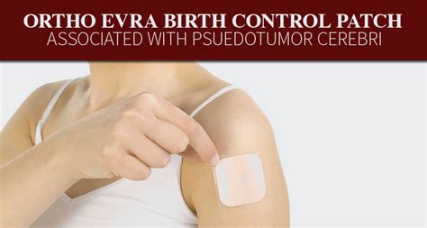 How To Use Ortho Evra Patch