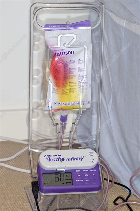 How To Use Peg Feed Machine