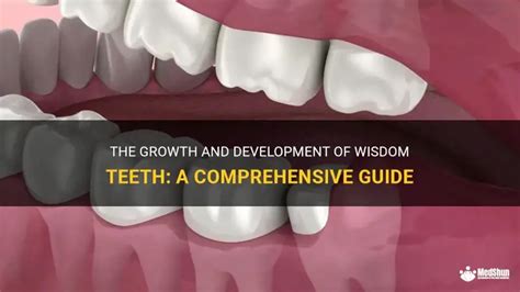 how to wisdom teeth grow
