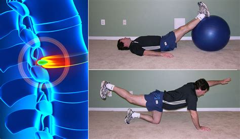 how to work out with a bulging disc