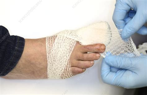How To Wrap Gauze Around Toe